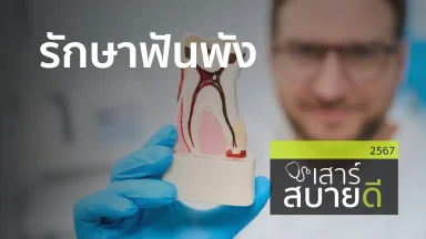 รักษาฟันพัง | 23 พ.ย. 67 |